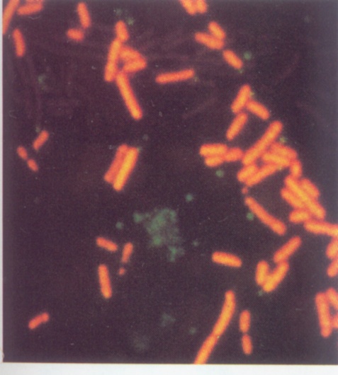 荧光抗体染色之大肠杆菌_食品微生物检验_食